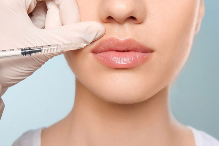 23.-Dermal-Fillers