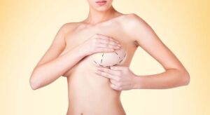 Breast-Augmentation-Surgery