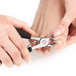 Nail Scissors for Ingrown Toenails