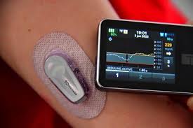 France Diabetes Device Market