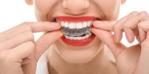 Global Orthodontics Market