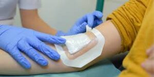 Medical Adhesives Market